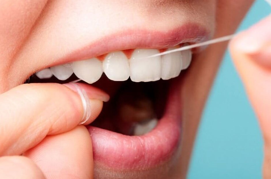 How Often Should I Floss