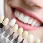 How To Make Your Teeth Healthy Again After Damage Or Decay