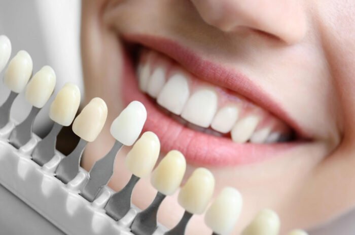 How To Make Your Teeth Healthy Again After Damage Or Decay